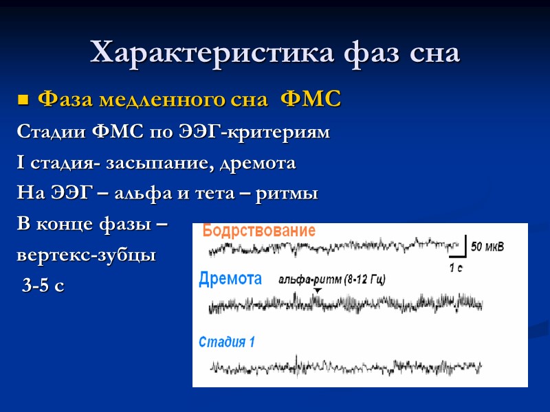 Характеристика фаз сна Фаза медленного сна  ФМС Стадии ФМС по ЭЭГ-критериям I стадия-